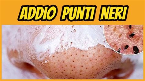 punti neri youtube|come eliminare i punti neri.